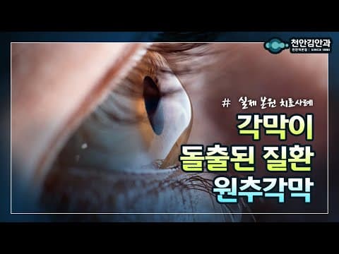 원추각막, 각막의 모양이 원뿔처럼 튀어나온다면?!