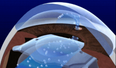 더 넓어진 광학부