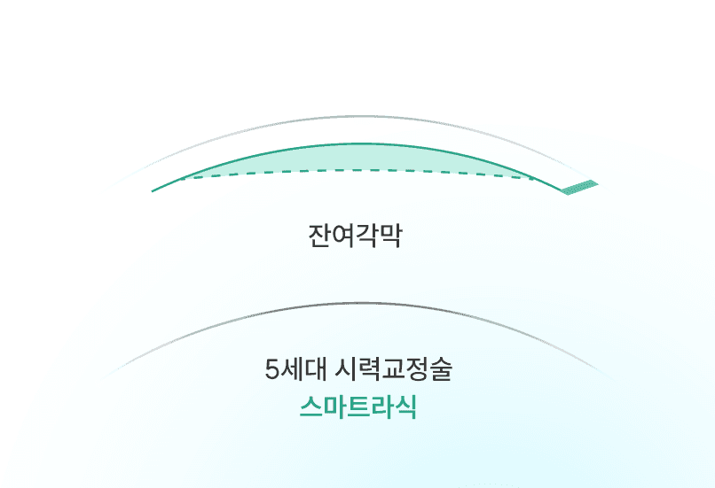 アーチ型レンティクルデザイン