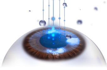 サイドカットなし、残余角膜を最大保存