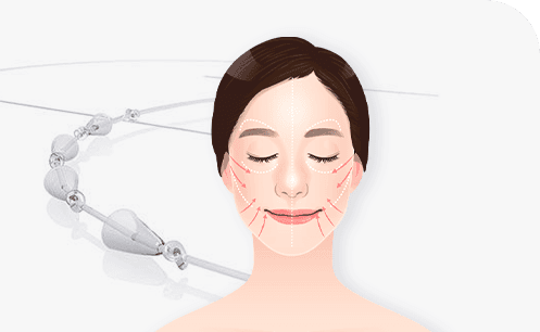 Bidirectional Cone System