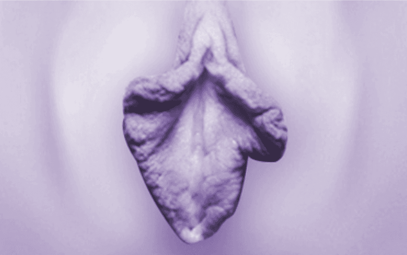 음핵 덮개 주름이 많은 소음순